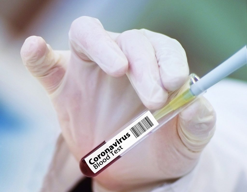 Coronavirus